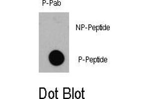 Image no. 1 for anti-Eukaryotic Translation Initiation Factor 4E Binding Protein 1 (EIF4EBP1) (pThr36) antibody (ABIN358355) (eIF4EBP1 抗体  (pThr36))