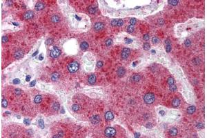 Immunohistochemistry (Formalin-fixed Paraffin-embedded Sections) (IHC (fp)) image for anti-Methylenetetrahydrofolate Dehydrogenase (NADP+ Dependent) 1, Methenyltetrahydrofolate Cyclohydrolase, Formyltetrahydrofolate Synthetase (MTHFD1) (AA 74-123) antibody (ABIN6747102)
