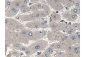 Detection of SMN2 in Human Liver Tissue using Polyclonal Antibody to Survival Of Motor Neuron 2, Centromeric (SMN2) (SMN2 抗体  (AA 16-251))