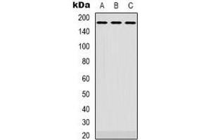Western blot analysis of EGFR expression in Hela (A), SKOV3 (B), A431 (C) whole cell lysates. (EGFR 抗体  (C-Term))