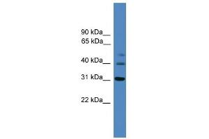 WB Suggested Anti-TRIB1 Antibody Titration: 0. (TRIB1 抗体  (C-Term))