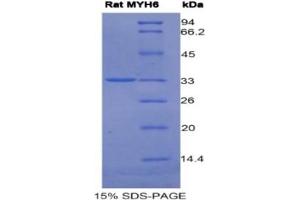 SDS-PAGE (SDS) image for Myosin Heavy Chain 6, Cardiac Muscle, alpha (MYH6) ELISA Kit (ABIN6574317)