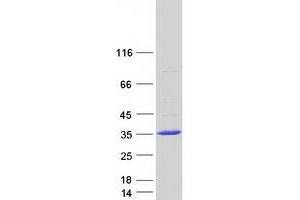 FAM109B Protein (Myc-DYKDDDDK Tag)