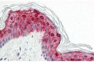 Immunohistochemistry (Paraffin-embedded Sections) (IHC (p)) image for anti-Zinc Finger, DHHC-Type Containing 9 (ZDHHC9) (C-Term) antibody (ABIN1449763)