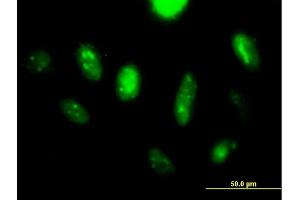 Immunofluorescence of purified MaxPab antibody to LANCL2 on HeLa cell. (LANCL2 抗体  (AA 1-450))