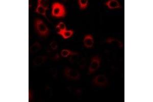 Immunofluorescent analysis of RANBP5 staining in Hela cells. (Importin 5 抗体)