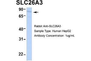 Host: Rabbit Target Name: SLC26A3 Sample Type: HepG2 Antibody Dilution: 1. (SLC26A3 抗体  (Middle Region))