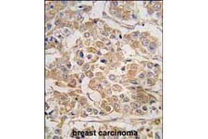 Immunohistochemistry (Paraffin-embedded Sections) (IHC (p)) image for anti-Inhibitor of kappa Light Polypeptide Gene Enhancer in B-Cells, Kinase epsilon (IKBKE) (AA 686-716), (C-Term) antibody (ABIN392751)