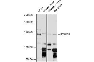 Western blot analysis of extracts of various cell lines, using POLR3B Antibody (ABIN6132503, ABIN6145938, ABIN6145939 and ABIN6216383) at 1:3000 dilution. (POLR3B 抗体  (AA 680-900))
