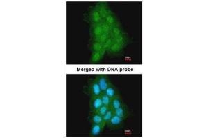 ICC/IF Image Immunofluorescence analysis of paraformaldehyde-fixed A431, using MAGEA11, antibody at 1:500 dilution. (MAGEA11 抗体  (N-Term))
