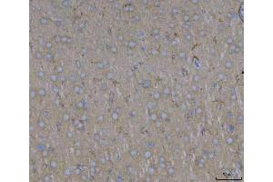 IHC analysis of ADAM22 using anti-ADAM22 antibody (ABIN7600714).