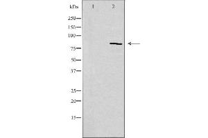 Western blot analysis of extracts from Jurkat cells, using CDH11 antibody. (OB Cadherin 抗体  (Internal Region))