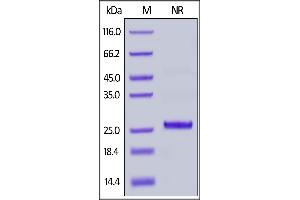 SDS-PAGE (SDS) image for Complement Factor D (CFD) (AA 26-253) protein (His tag) (ABIN6951009)