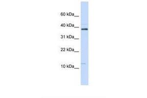 Image no. 1 for anti-serine Peptidase Inhibitor, Kazal Type 1 (SPINK1) (N-Term) antibody (ABIN6737738)
