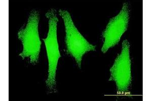 Immunofluorescence of monoclonal antibody to LMO1 on HeLa cell. (LMO1 抗体  (AA 1-90))