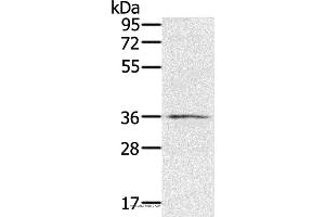 Western blot analysis of TM4 cell, using RNF144B Polyclonal Antibody at dilution of 1:400 (RNF144B 抗体)