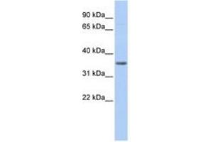 Image no. 1 for anti-Pyruvate Dehydrogenase beta (PDHB) (AA 72-121) antibody (ABIN6741021) (PDHB 抗体  (AA 72-121))
