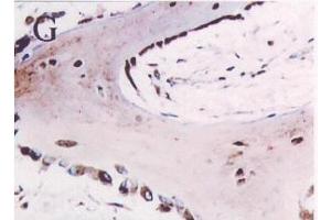 Immunohistochemistry image of Osteonectin staining in par- affn section offetal calvaria. (SPARC 抗体)