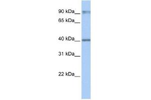 Western Blot showing AIM2 antibody used at a concentration of 1-2 ug/ml to detect its target protein. (AIM2 抗体  (N-Term))
