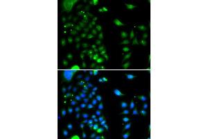 Immunofluorescence analysis of MCF-7 cells using UBE2J2 antibody (ABIN5974418). (UBE2J2 抗体)