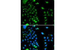 Immunofluorescence analysis of MCF-7 cells using UBE2J2 antibody (ABIN5974418). (UBE2J2 抗体)