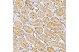 Immunohistochemistry (IHC) image for anti-Chloride Intracellular Channel 4 (CLIC4) (AA 1-253) antibody (ABIN6138723)