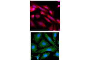 ICC/IF analysis of MAPK3 in HeLa cells line, stained with Hoechst 3342 (Blue) for nucleus staining and monoclonal anti-human MAPK3 antibody (1:500) with goat anti-mouse IgG-Texas Red conjugate (Red).