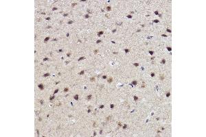 Immunohistochemistry of paraffin-embedded mouse brain using  Rabbit mAb (ABIN7265552) at dilution of 1:100 (40x lens). (ALKBH1 抗体)