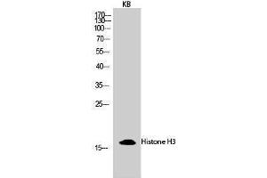Western Blotting (WB) image for anti-Histone 3 (H3) (Lys428) antibody (ABIN3185033) (Histone 3 抗体  (Lys428))