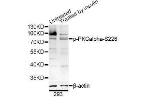Western blot analysis of extracts of 293 cells, using Phospho-PKCalpha-S226 antibody (ABIN5996200) at 1/1000 dilution. (PKC alpha 抗体  (pSer226))
