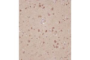 Immunohistochemistry (Paraffin-embedded Sections) (IHC (p)) image for anti-STE20-Related Kinase Adaptor alpha (STRADA) (AA 303-346), (C-Term) antibody (ABIN1981302)