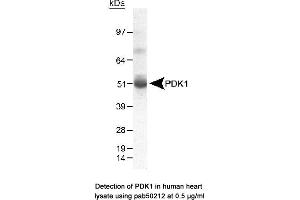 Image no. 1 for anti-Pyruvate Dehydrogenase Kinase (AA 300-400) antibody (ABIN363521) (Pyruvate Dehydrogenase Kinase (AA 300-400) 抗体)