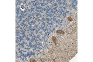 Immunohistochemical staining of human cerebellum with NEXN polyclonal antibody  shows moderate cytoplasmic positivity in purkinje cells. (NEXN 抗体)