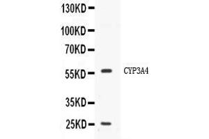 Western blot analysis of CYP3A4 expression in HELA whole cell lysates ( Lane 1). (CYP3A4 抗体  (Middle Region))