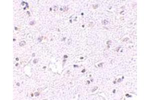 Immunohistochemical staining of human brain tissue with 2. (LASS5 抗体  (N-Term))