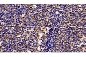 Detection of IFNa/bR2 in Porcine Lymph node Tissue using Polyclonal Antibody to Interferon Alpha/Beta Receptor 2 (IFNa/bR2)
