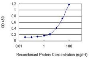 Detection limit for recombinant GST tagged LYPD5 is 0. (LYPD5 抗体  (AA 71-180))