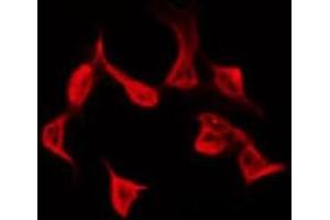 ABIN6278625 staining COLO205 by IF/ICC. (RASSF4 抗体  (Internal Region))