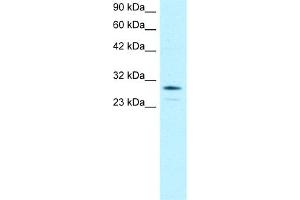 WB Suggested Anti-OTX2 Antibody Titration:  0. (OTX2 抗体  (N-Term))