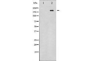 Western blot analysis of HER4 expression in whole cell lysates,The lane on the left is treated with the antigen-specific peptide. (ERBB4 抗体  (C-Term))