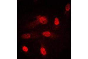 Immunofluorescent analysis of SGK1/2 staining in HeLa cells. (SGK1/2 (Center) 抗体)