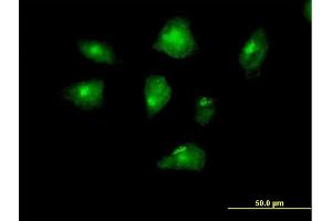 Immunofluorescence of purified MaxPab antibody to FSHPRH1 on HeLa cell.