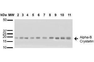 Western blot analysis of Human A431, HCT116, HeLa, HepG2, HEK293, HUVEC, Jurkat, MCF7, PC3 and T98G cell lysates showing detection of ~22 kDa Alpha B Crystallin protein using Rabbit Anti-Alpha B Crystallin Polyclonal Antibody (ABIN361836 and ABIN361837). (CRYAB 抗体)