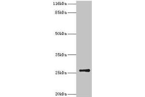 Western blot All lanes: TK1 antibody at 2 μg/mL + CEM whole cell lysate Secondary Goat polyclonal to rabbit IgG at 1/10000 dilution Predicted band size: 26 kDa Observed band size: 26 kDa (TK1 抗体  (AA 2-234))