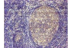 Immunohistochemical staining of paraffin-embedded Human tonsil using anti-MAGEB18 mouse monoclonal antibody. (MAGEB18 抗体)