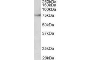 Western Blotting (WB) image for anti-Far Upstream Element (FUSE) Binding Protein 1 (FUBP1) (Internal Region) antibody (ABIN2465130) (FUBP1 抗体  (Internal Region))