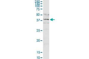 Western Blotting (WB) image for anti-Asporin (ASPN) (AA 1-384) antibody (ABIN527209)