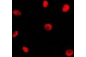Immunofluorescent analysis of RAD21 staining in Jurkat cells. (RAD21 抗体  (C-Term))