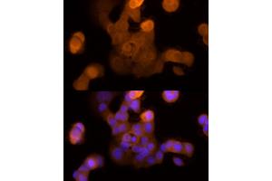 Immunofluorescence (IF) image for anti-Galectin 3 (LGALS3) antibody (ABIN7267337)