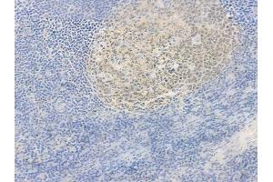 ABIN6264360 and ABIN6278002 at 1/100 staining human normal tonsil tissue by IHC-P. (POU2AF1 抗体  (C-Term))